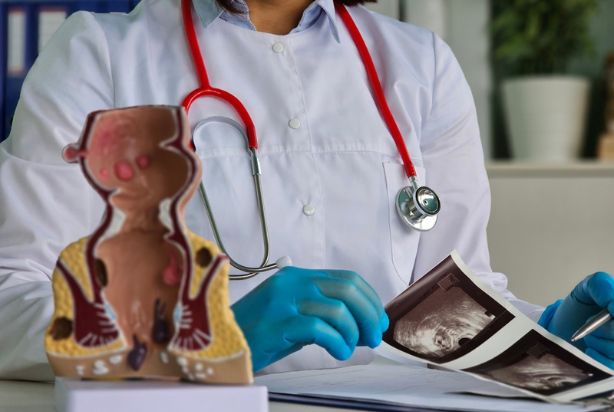 Exame de toque retal: o que você precisa saber sobre